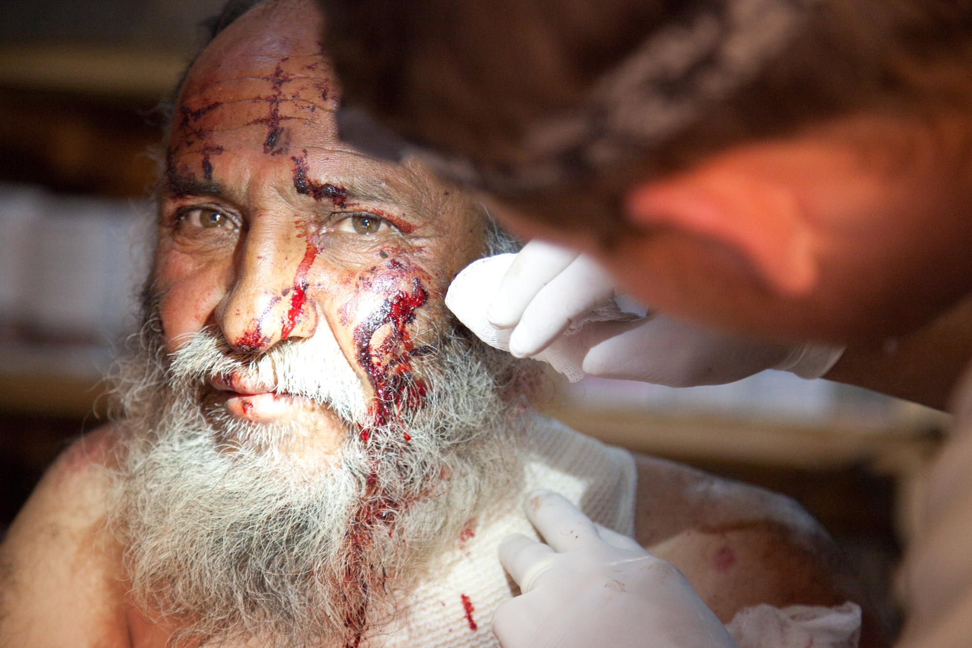 Human costs: An Afghan resident, wounded by an insurgent grenade, receives medical treatment from a U.S. Navy corpsman near Kalach in the Oruzgan district of Afghanistan. Credit: U.S. Army photo by Pfc. Simon Lee/Released