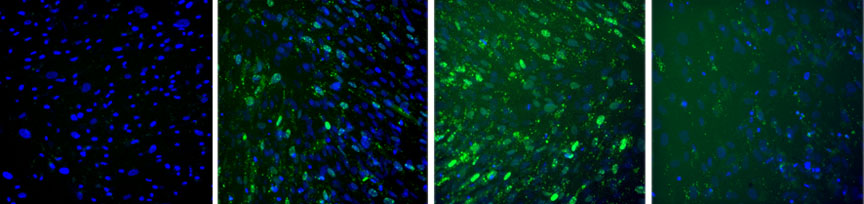 Time lapse: Becoming bone: A population of fat-derived stem cells expresses the bone-specific COL1A1 gene. Green fluorescence from a “molecular beacon” shows increasing expression from day 9, left, through day 11 and day 14. By day 16, right, expression begins to wane. Credit: Darling Lab/Brown University Time lapse: Becoming bone: A population of fat-derived stem cells expresses the bone-specific COL1A1 gene. Green fluorescence from a “molecular beacon” shows increasing expression from day 9, left, through day 11 and day 14. By day 16, right, expression begins to wane. Credit: Darling Lab/Brown University