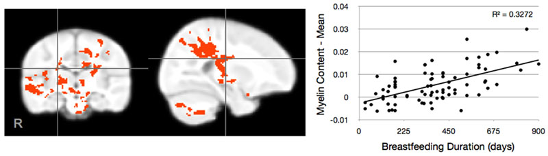 Changes “almost right off the bat”: Mean myelin content — the fatty material that insulates nerve fibers and speeds electrical signals — rises with breastfeeding. The changes to developing brains happen early, almost from the start. Credit: Baby Imaging Lab/Brown University Changes “almost right off the bat”: Mean myelin content — the fatty material that insulates nerve fibers and speeds electrical signals — rises with breastfeeding. The changes to developing brains happen early, almost from the start. Credit: Baby Imaging Lab/Brown University